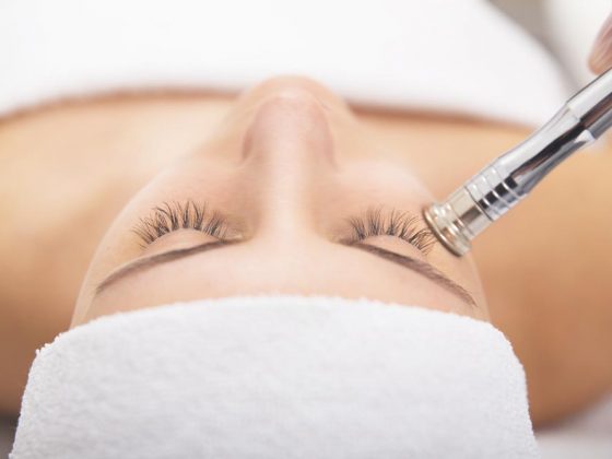 Microdermabrasion treatment